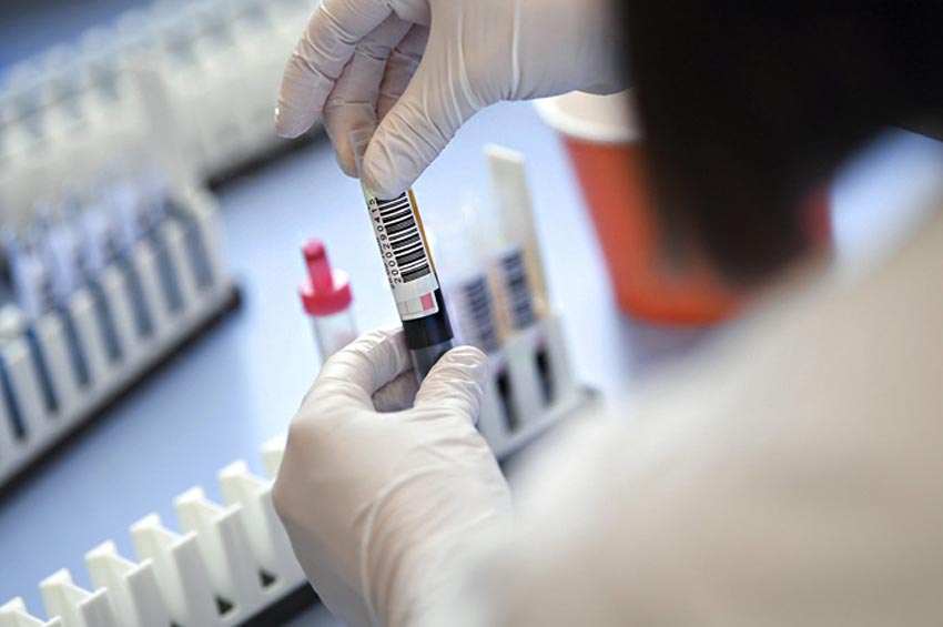 На Хмельниччині кількість підтверджених випадків коронавірусу наближається до 44 тисяч