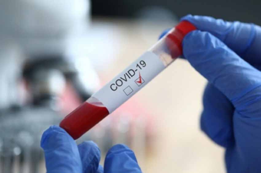На Хмельниччині додалося ще 2 летальних випадки від коронавірусу
