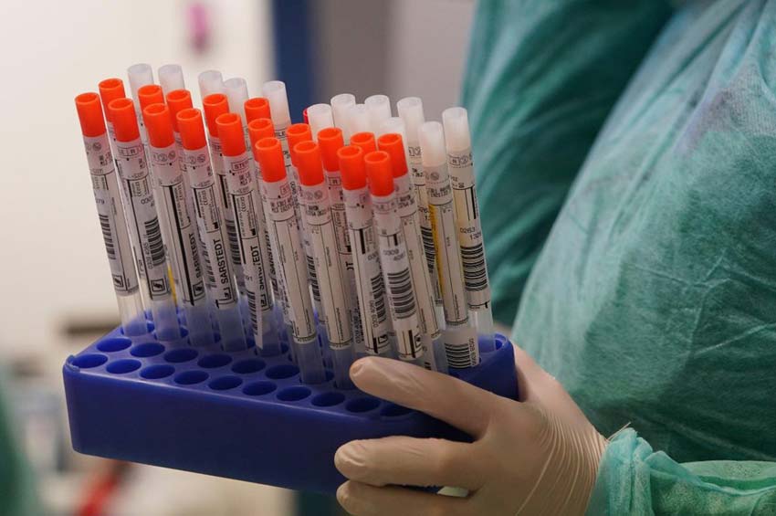 На Хмельниччині від коронавірусу вже померли 1247 людей від початку пандемії
