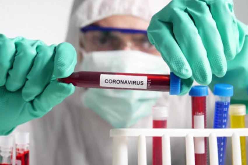 COVID-19 в Хмельницькій області: за останню добу виявлено 276 нових випадків захворювання, 24 людини померло