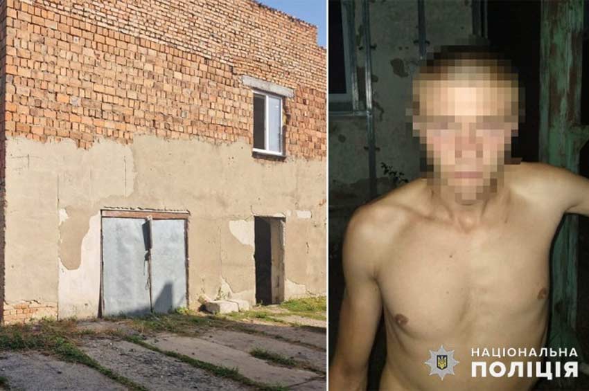 У Шепетівці молодик у стані алкогольного сп’яніння сильно побив знайомого