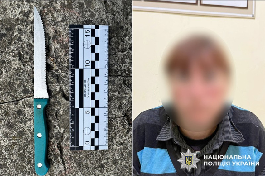 На Шепетівщині 37-річна жінка під час сварки вдарила знайому ножем у живіт