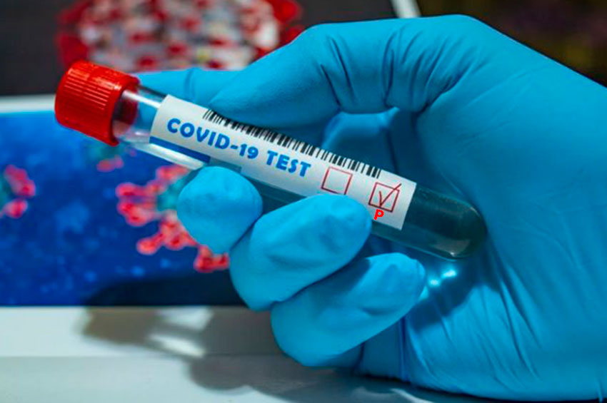 Перший випадок коронавірусу в Дунаєвецькому районі та 178 загалом в області  